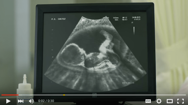 Screen Shot 2016-03-29 at 11.56.59 PM.png